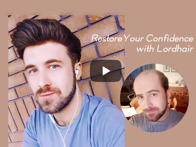 Changing Lives with Lordhair Non-surgical Hair Replacement Systems